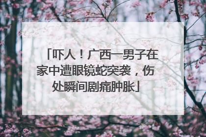 吓人！广西一男子在家中遭眼镜蛇突袭，伤处瞬间剧痛肿胀